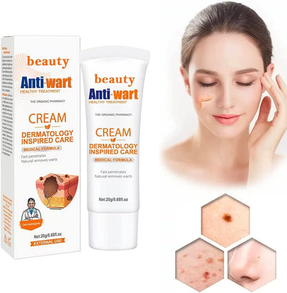 Crema Antiverrugas – Eliminación Rápida y Sin Dolor